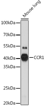 CCR1 Polyclonal Antibody (E-AB-92022)