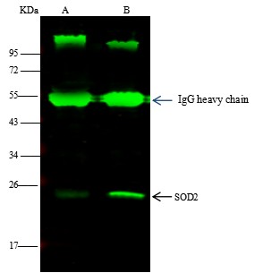 Recombinant SOD2 Monoclonal Antibody (AN300260P)