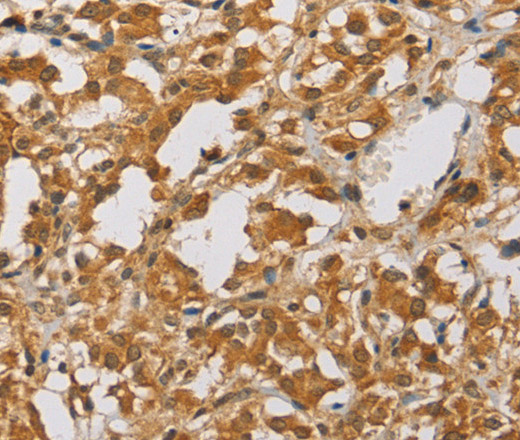 ARHGEF5 Polyclonal Antibody (E-AB-14607)