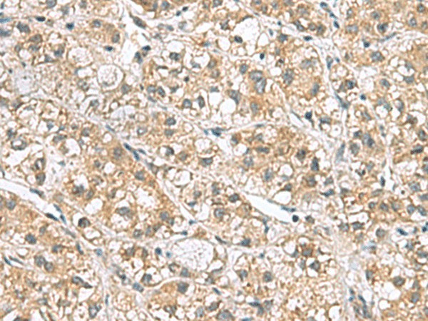 PPIH Polyclonal Antibody (E-AB-53064)