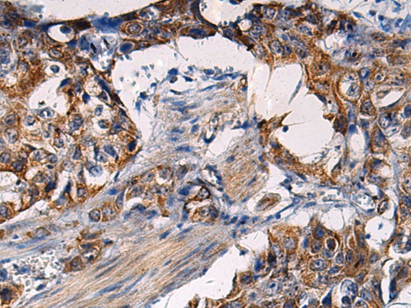 RITA1 Polyclonal Antibody (E-AB-53132)