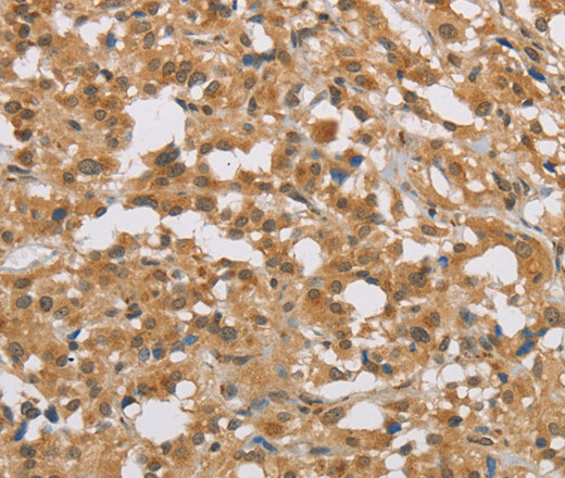 DIO1 Polyclonal Antibody (E-AB-14929)