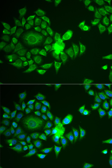 NDUFS4 Polyclonal Antibody (E-AB-64690)