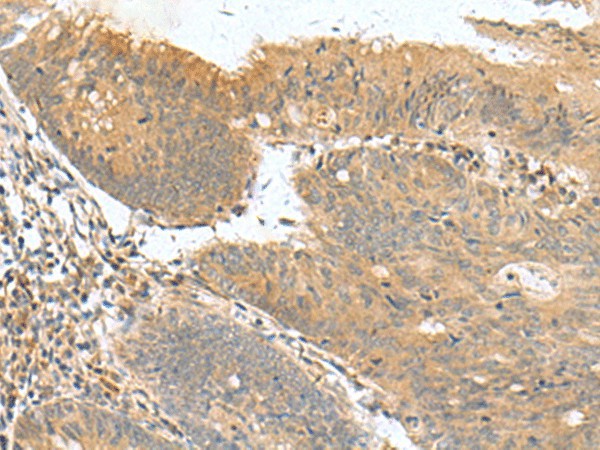 HHIPL2 Polyclonal Antibody (E-AB-53123)