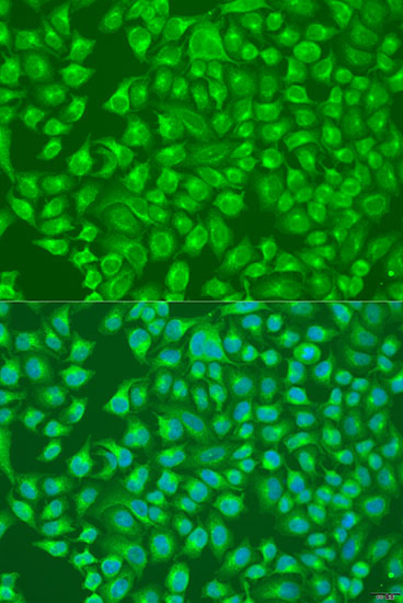 SLC12A6 Polyclonal Antibody (E-AB-67960)