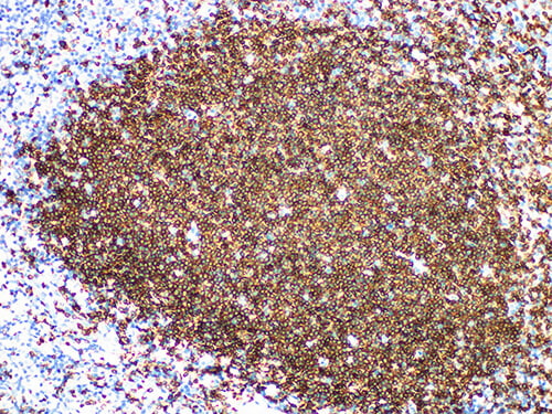 CD79a Monoclonal Antibody (ELAB6614-R)