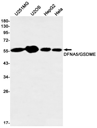 Recombinant GSDME Monoclonal Antibody (E-AB-81466)