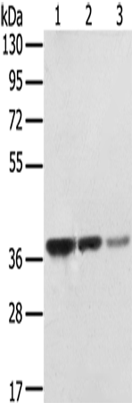 STX16 Polyclonal Antibody (E-AB-15431)