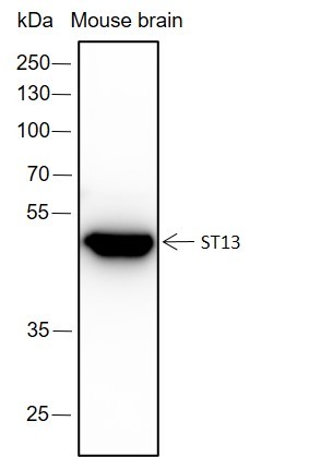 Recombinant ST13 Monoclonal Antibody (AN301664L)