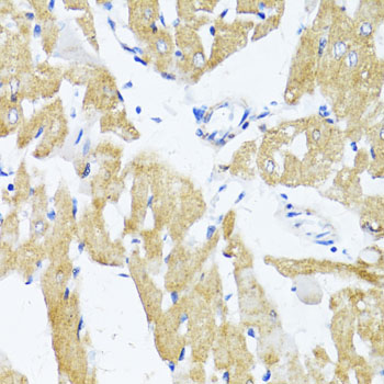 GLUT4 Polyclonal Antibody (E-AB-62919)