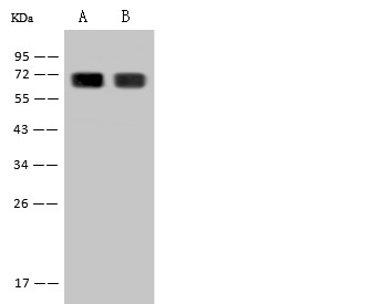 Recombinant Hemopexin/HPX Monoclonal Antibody (AN300592P)