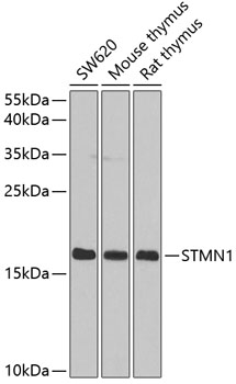 STMN1 Polyclonal Antibody (E-AB-60661)