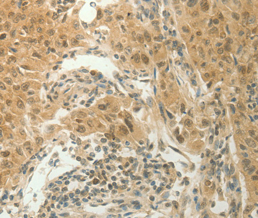 SLC8A3 Polyclonal Antibody (E-AB-12798)