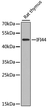 IFI44 Polyclonal Antibody (E-AB-63040)