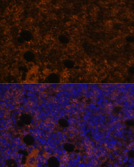 CD11B Polyclonal Antibody (E-AB-60354)