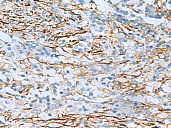 DPYSL3 Polyclonal Antibody (E-AB-18723)