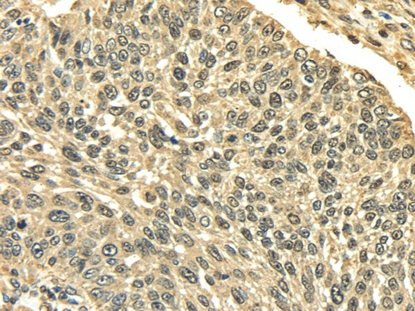PLIN3 Polyclonal Antibody (E-AB-17095)