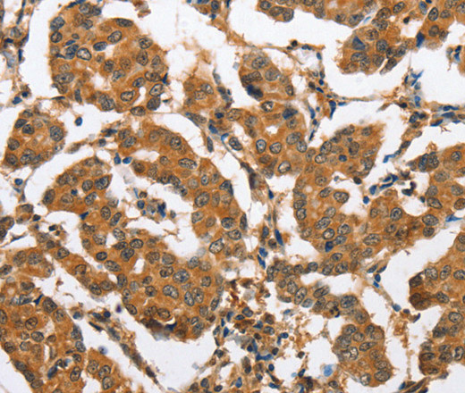 CXCL14 Polyclonal Antibody (E-AB-14099)