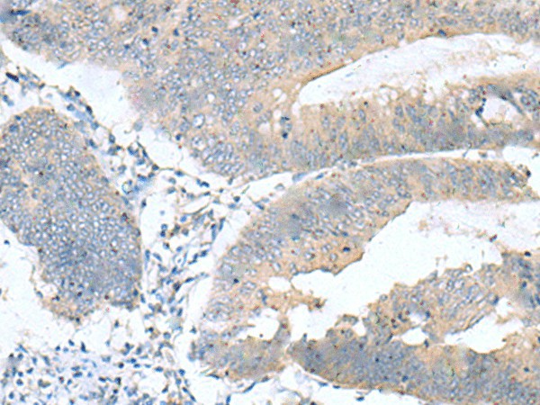 KRCC1 Polyclonal Antibody (E-AB-53125)