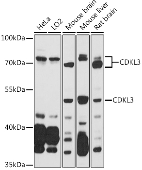 CDKL3 Polyclonal Antibody (E-AB-91610)