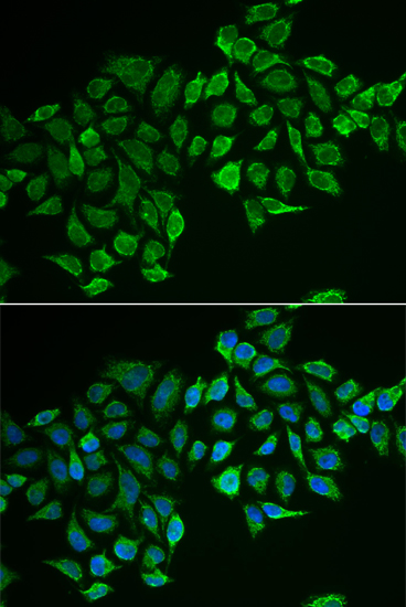 RHOD Polyclonal Antibody (E-AB-63105)