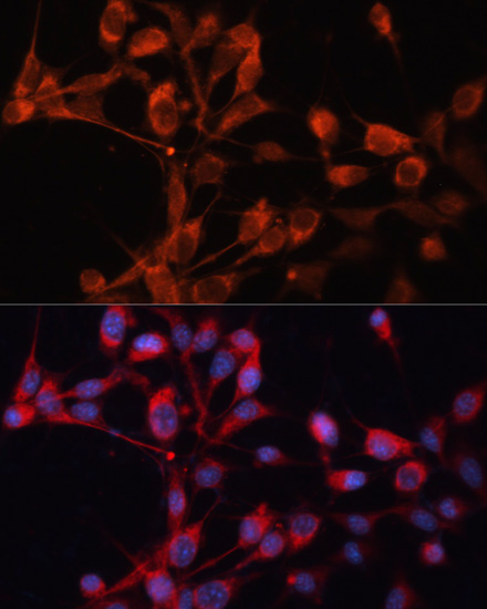 SLC25A19 Polyclonal Antibody (E-AB-65956)