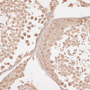 VEGF Receptor 2 Polyclonal Antibody (E-AB-63481)