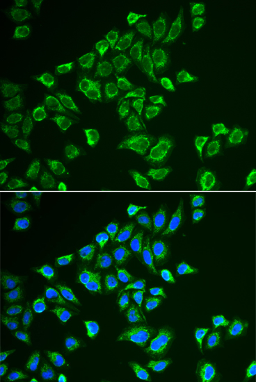 TAC3 Polyclonal Antibody (E-AB-61880)