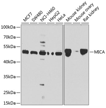 MICA Polyclonal Antibody (E-AB-60301)