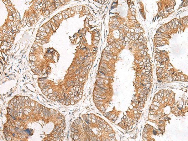 FERD3L Polyclonal Antibody (E-AB-19865)