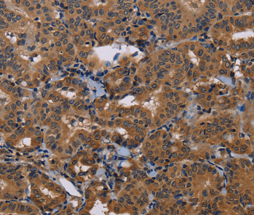 GRK1 Polyclonal Antibody (E-AB-15702)