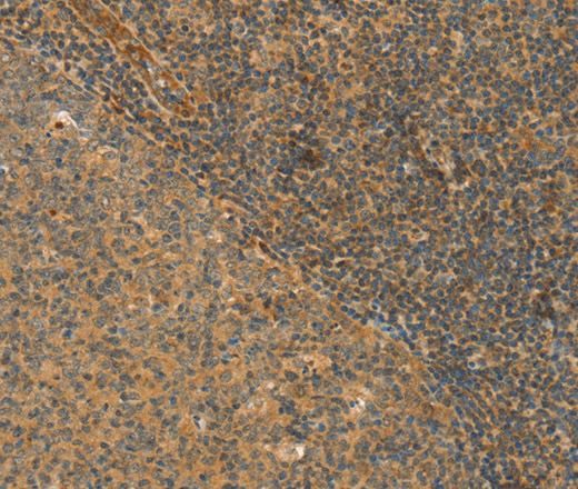 CPA2 Polyclonal Antibody (E-AB-14888)