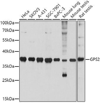 GPS2 Polyclonal Antibody (E-AB-92558)