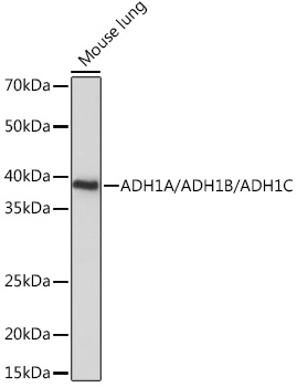 ADH1A/ADH1B/ADH1C Polyclonal Antibody (E-AB-92097)