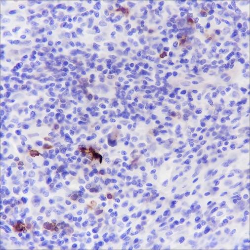 Recombinant CD134/OX40 Monoclonal Antibody (AN301462L)
