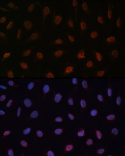 MED25 Polyclonal Antibody (E-AB-66704)