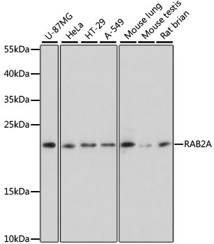 RAB2A Polyclonal Antibody (E-AB-92395)