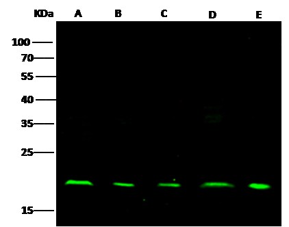 Recombinant NME1/NDKA Monoclonal Antibody (AN300066P)