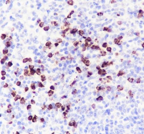 Recombinant MMP8 Monoclonal Antibody (AN301867L)