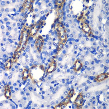 MATK Polyclonal Antibody (E-AB-61273)