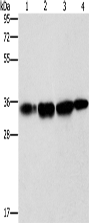 NSMCE3 Polyclonal Antibody (E-AB-16215)