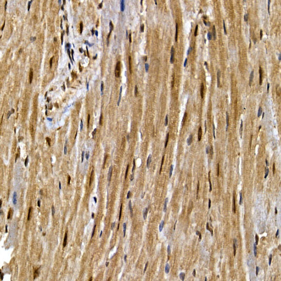 PPAR gamma Polyclonal Antibody (E-AB-68251)