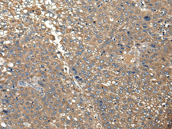 DGKI Polyclonal Antibody (E-AB-19733)