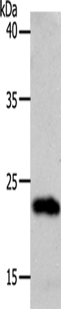 SOCS1 Polyclonal Antibody (E-AB-12648)