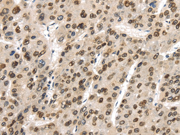 TUSC5 Polyclonal Antibody (E-AB-17489)