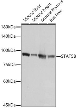 (KO Validated) STAT5B Polyclonal Antibody (E-AB-92402)