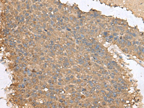 FAM19A4 Polyclonal Antibody (E-AB-53038)