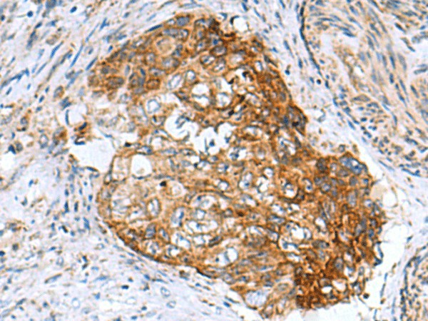 AP1S3 Polyclonal Antibody (E-AB-53014)