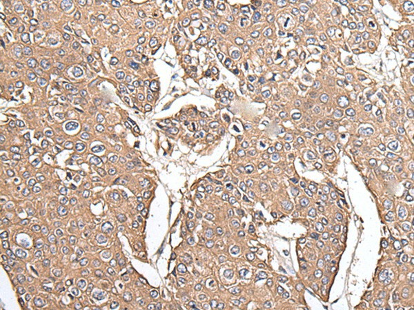 KRT73 Polyclonal Antibody (E-AB-52251)