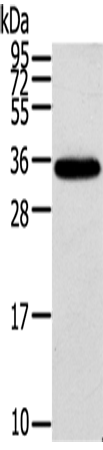 KCNMB3 Polyclonal Antibody (E-AB-16541)